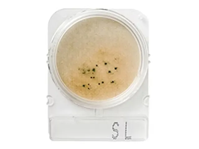 Compact Dry Salmonella SL 100 Testes