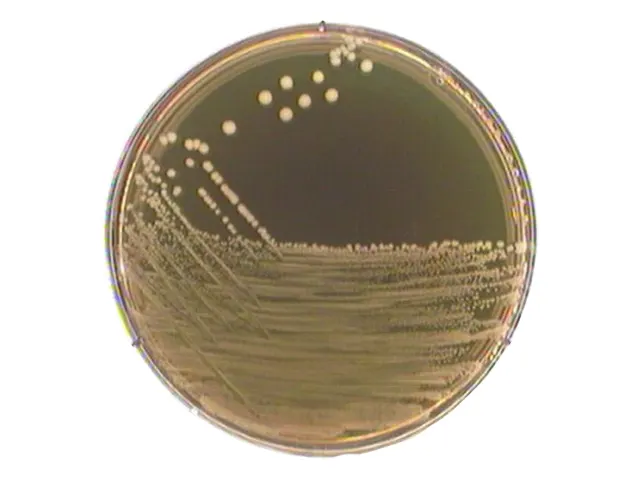 Ágar M17 Seg Terzaghi Merck 500g